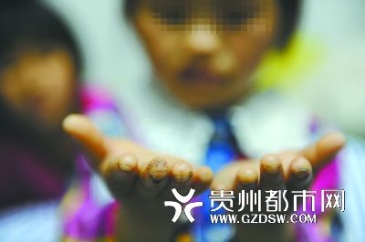 指尖被針扎得傷痕累累。