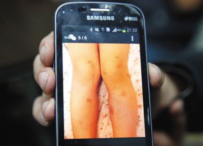 朝陽(yáng)一幼兒園 女老師長(zhǎng)期打多名兒童