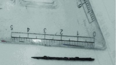 取出的繡花針已發(fā)黑生銹。