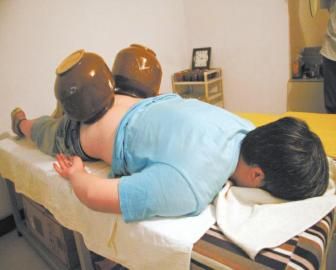 拔泡菜壇子火罐。