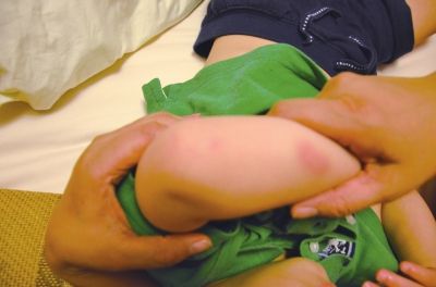 孩子身上有多處明顯傷痕。京華時(shí)報(bào)讀者供圖