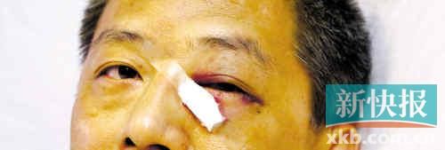 ■這起醫(yī)鬧事件，受傷的遠遠不只是熊旭明醫(yī)生的身體。