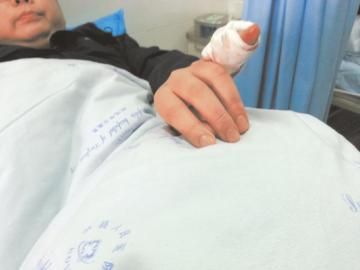 實(shí)習(xí)醫(yī)生陳洪左手的小拇指肌腱斷裂。