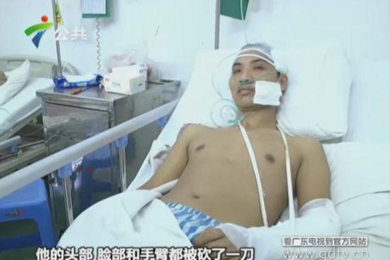 另一名傷者頭部、臉部和手臂都被砍了一刀。(視頻截圖)