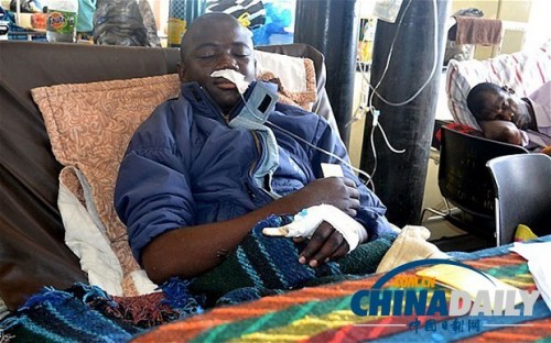 雖然已經(jīng)在醫(yī)院接受了近一個月的恢復(fù)治療，卡托卡的身體仍然非常虛弱。