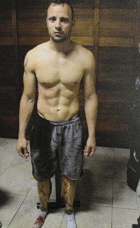 “刀鋒戰(zhàn)士”皮斯托瑞斯過失槍殺女友現(xiàn)場(chǎng)照片。