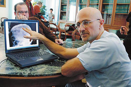 圖為卡納維洛醫(yī)生，不少人認(rèn)為他的想法非常瘋狂