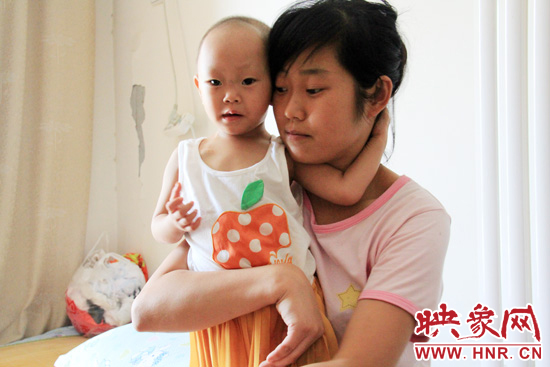 孩子和媽媽在一起，她的右眼已經(jīng)失明。