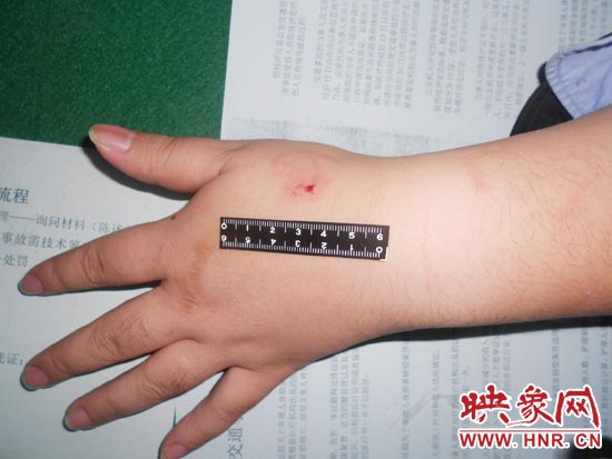 為幫助無證駕駛的朋友逃避處罰，新鄉(xiāng)的王某竟對執(zhí)勤民警大打出手，還將一名民警的手臂咬傷