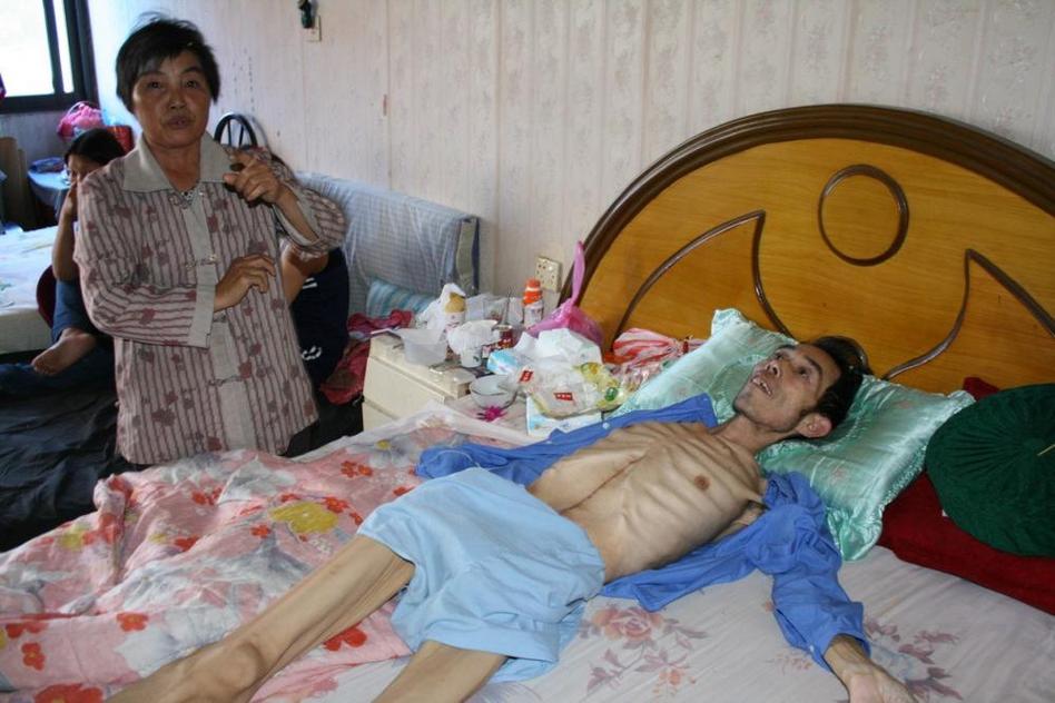 多地水污染嚴(yán)重 “癌癥村”人處境堪憂(yōu)