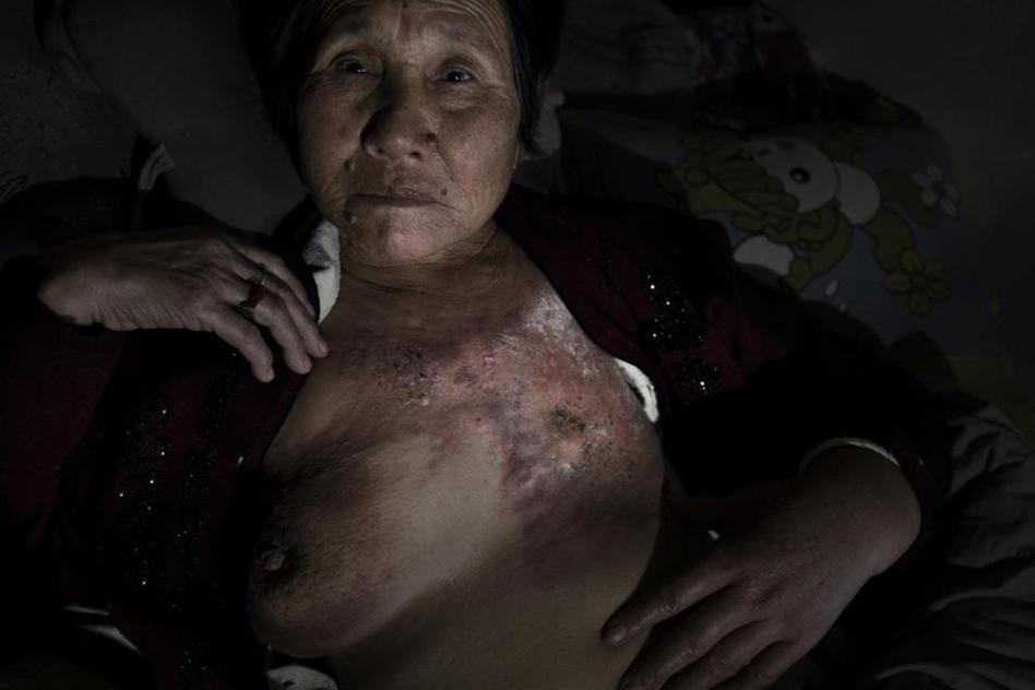 多地水污染嚴(yán)重 “癌癥村”人處境堪憂(yōu)