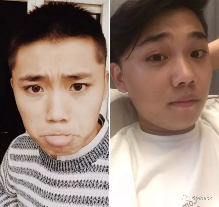 長胖20斤，臉型怎么變？這些例子看完扎心了！