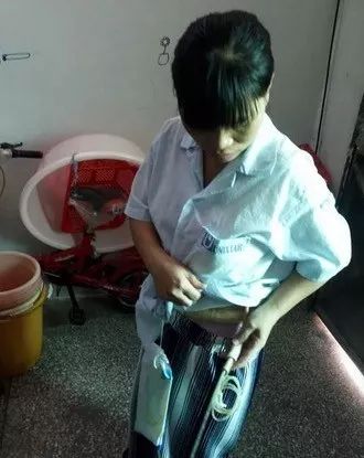 女子路上被撞200元私了 隔天病危入院1個(gè)月花掉7萬