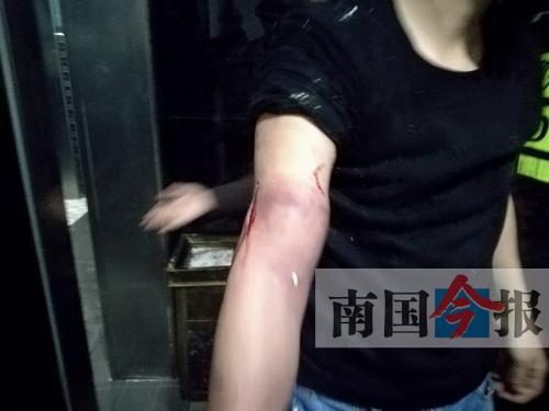 覃先生手臂被卡的部位受傷流血，所幸傷勢無大礙。 通訊員 王建民 攝