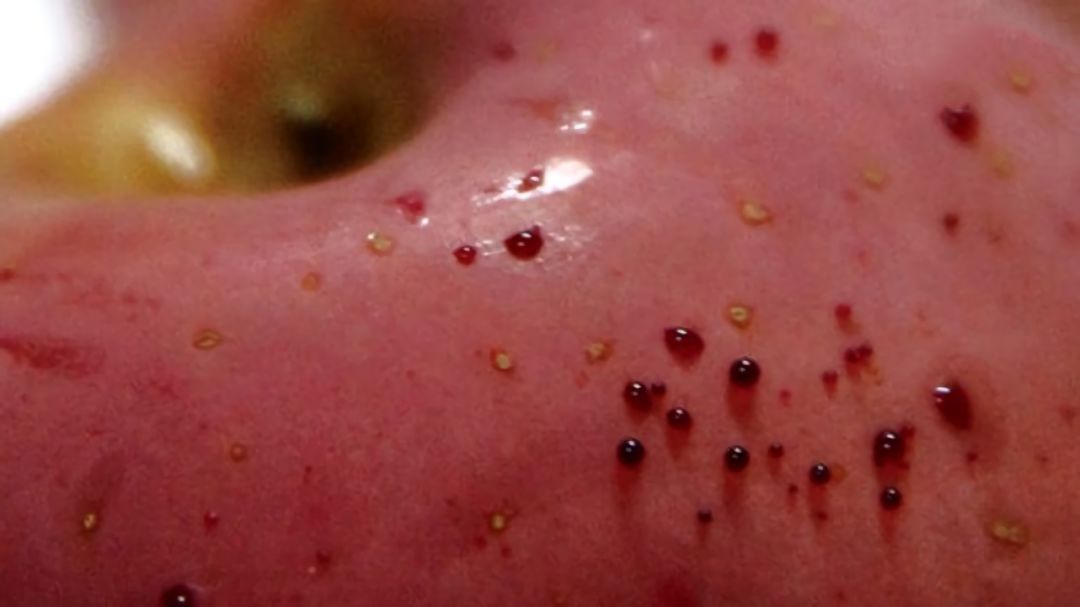 嚇懵！女子用熱水泡蘋果結(jié)果冒出血珠 咋回事？