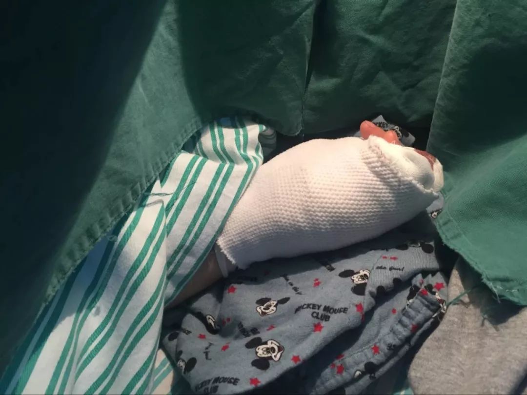 嚇哭！6歲男孩被夾斷手指 罪魁禍?zhǔn)拙故切７? oldsrc=