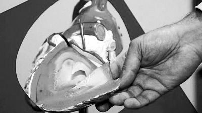 威廉斯領(lǐng)導(dǎo)的研究團(tuán)隊(duì)已經(jīng)利用人體脂肪干細(xì)胞，成功3D打印出心臟血管和心臟瓣膜，待一顆心臟的所有部件打