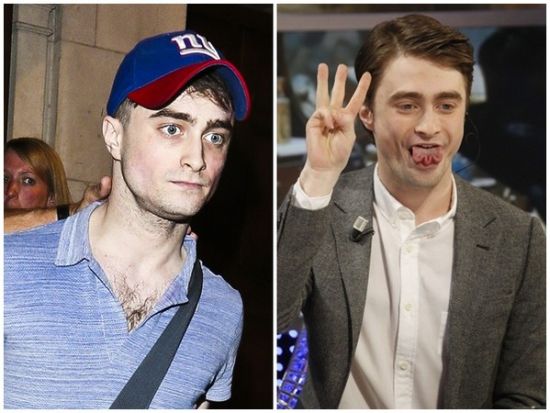 丹尼爾日前被拍到骨瘦如柴，不似2月份健康