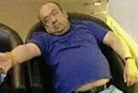 網(wǎng)傳金正男中毒后的照片。