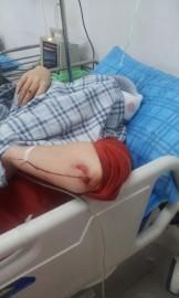 砸窗當(dāng)事人胡女士在醫(yī)院接受治療。