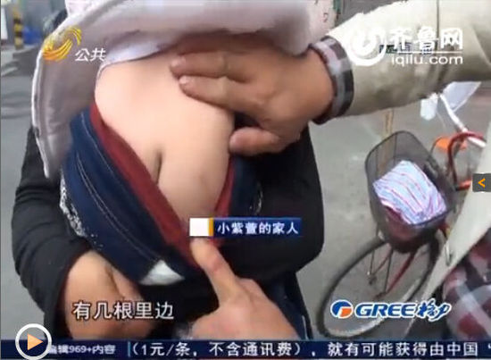 女嬰體內(nèi)現(xiàn)16根鋼針無(wú)法取出 父母懷疑被下黑手