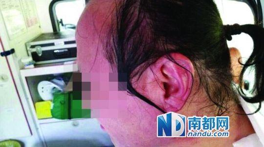 涉事教師遭熱水潑臉后的照片。