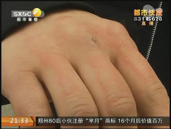 說到這足療拔罐，估計大伙都不陌生，但是想起4號晚上的拔罐的經(jīng)歷，呂先生現(xiàn)在想起來，還心有余悸。