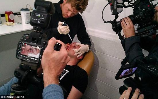 該實(shí)驗(yàn)是由加州一支名為“生物駭客”的實(shí)驗(yàn)團(tuán)隊(duì)開展的。他們使用了一種名為二氫卟吩e6（Ce6）的物質(zhì)的溶液。Ce6常見于深海魚體內(nèi)，有光敏特性，通常用于癌癥治療研究中。研究團(tuán)隊(duì)將Ce6與胰島素和鹽水混合起來，得到一種溶液，可以在低光照條件下提高人類的視力。