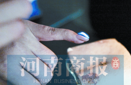 將指甲油涂在指甲上，靠近火焰時(shí)被引燃了