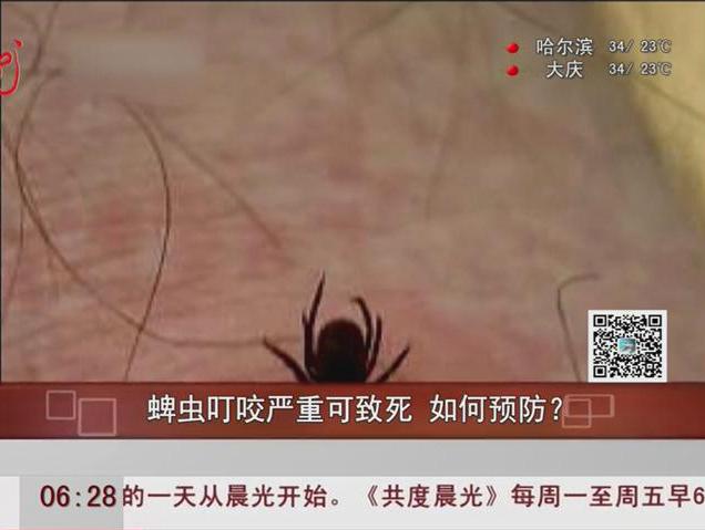 蜱蟲(chóng)叮咬嚴(yán)重可致死如何預(yù)防？