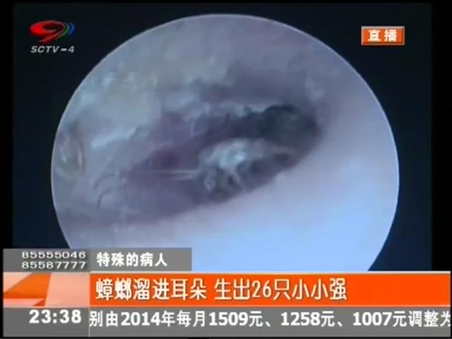 小強(qiáng)溜進(jìn)耳朵？生26只小小強(qiáng)