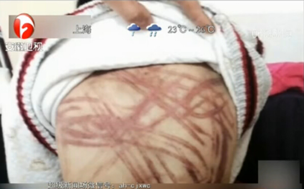 “虐童案”開(kāi)庭 養(yǎng)母堅(jiān)稱(chēng)無(wú)罪