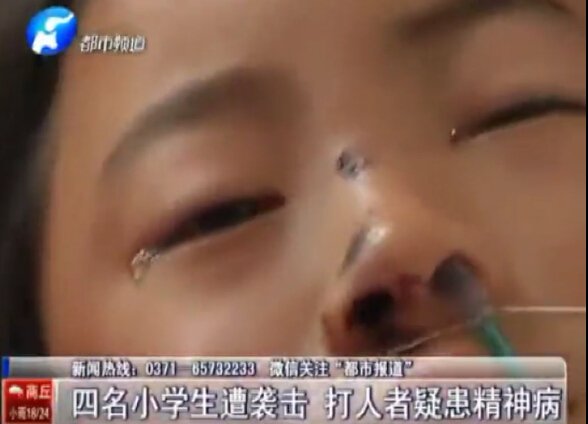 小學(xué)生突遭棍棒襲擊 傷勢嚴重