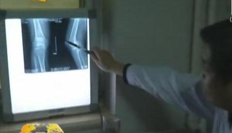 冷空氣來襲 如何預防老寒腿？