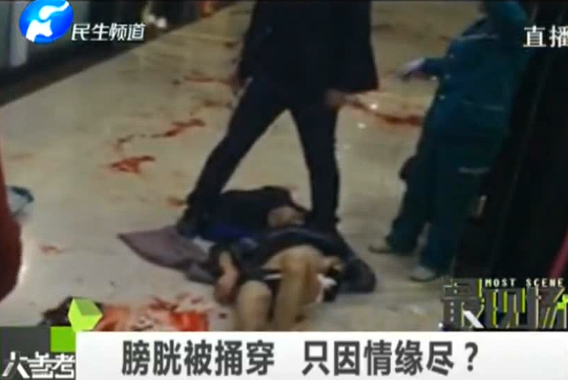 膀胱被捅穿 只因情緣盡？